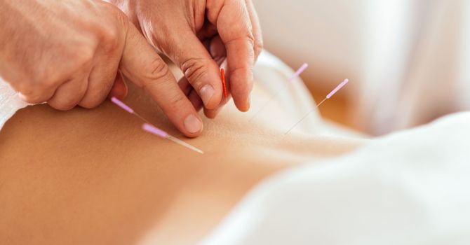 Acupuncture with Modalities and Bodywork