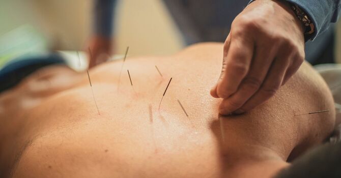 Initial Acupuncture Treatment ***All new clients, and returning clients over 1 year